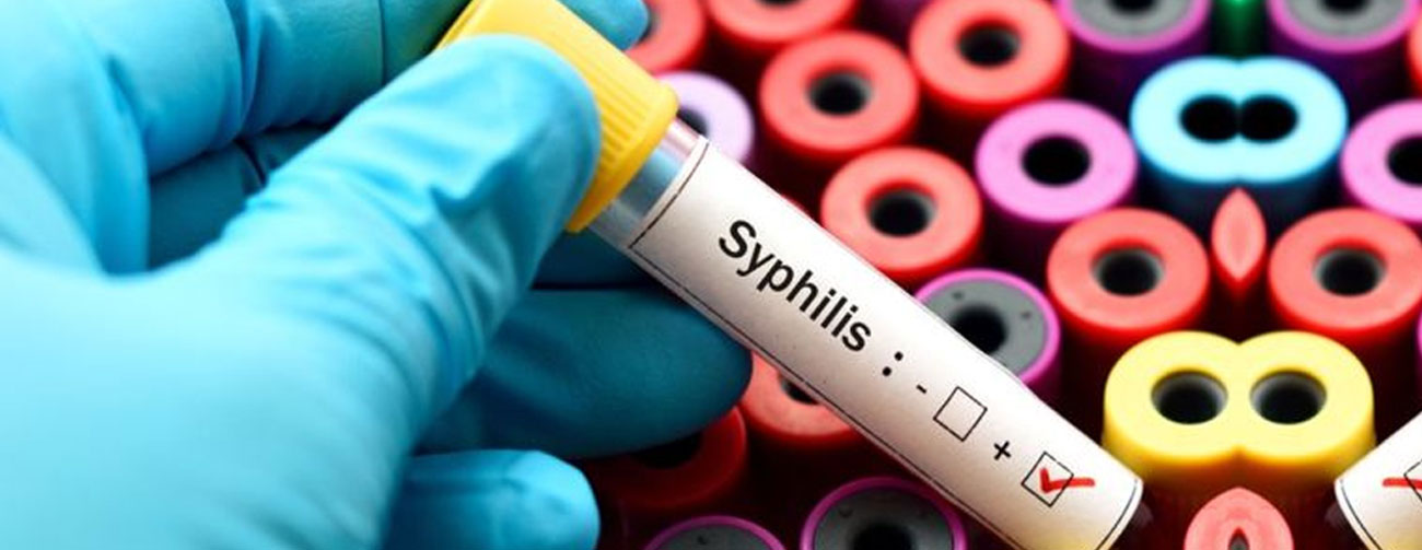 Syphilis Tests Clinihealth