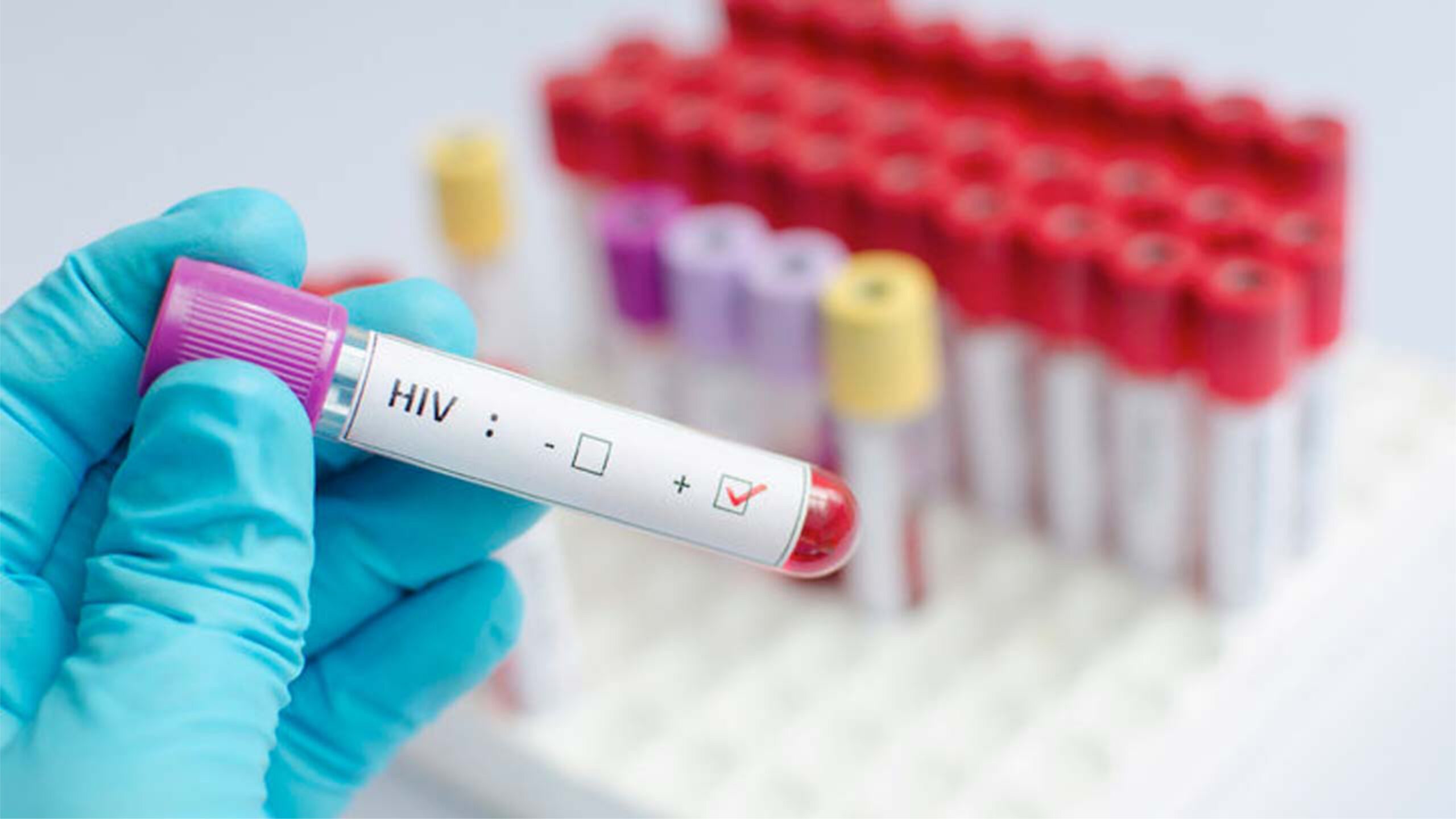 hiv testing